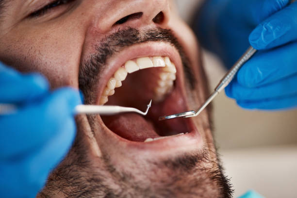 Best Emergency Denture Repair in St Charles, MI